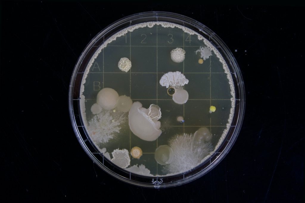 anaerobic bacteria in sewage treatment